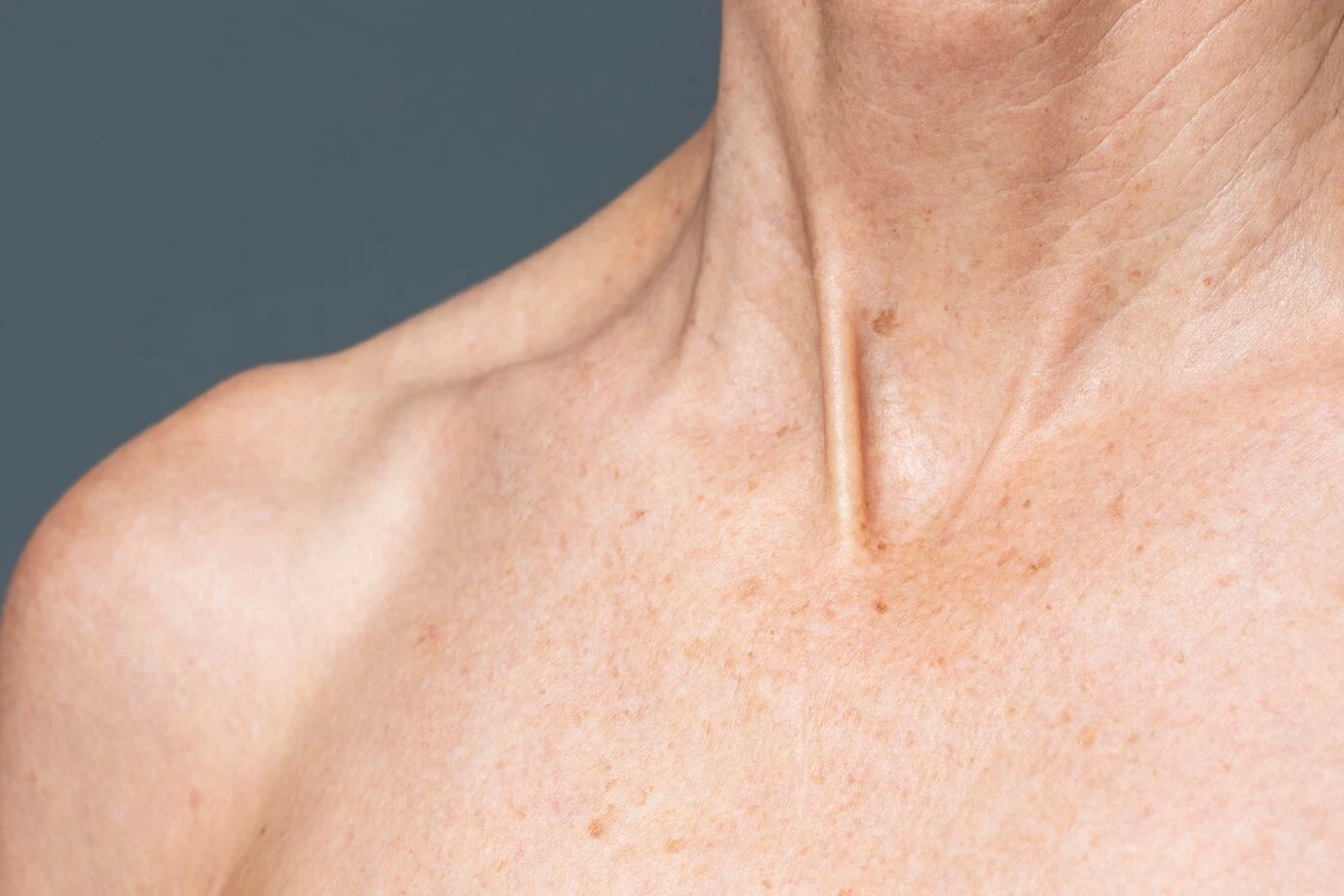 clinique spécialisé dans la chirurgie dermatologique à Paris